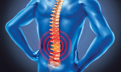 Vôi hóa cột sống: Nguyên nhân, triệu chứng, chẩn đoán và điều trị