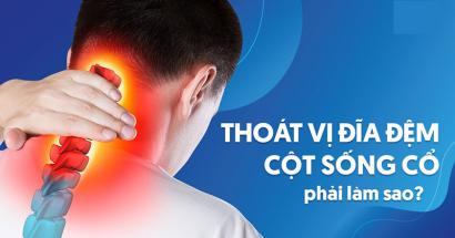 Phương pháp điều trị thoái hóa đốt sống cổ theo Y Học Hiện Đại